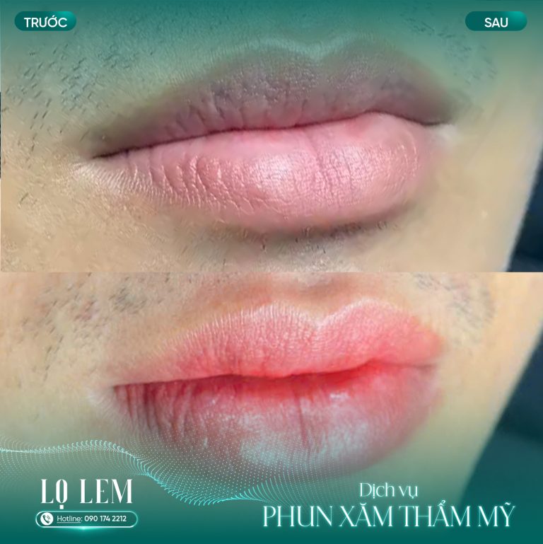 DV Phun xăm thẩm mỹ